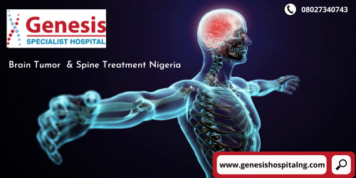 Looking for a Spine Hospital in Nigeria? Approach Genesis Specialist Hospital. They are a group of highly-trained professionals having years of expertise in their respective fields.
Learn More: https://genesishospitalng.com/departments/neurology/