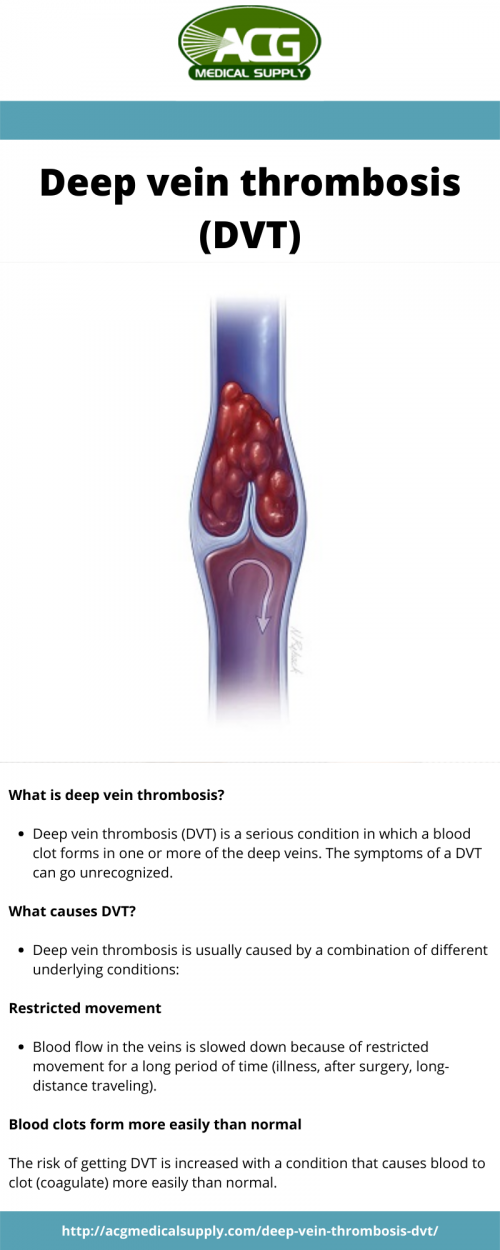 Deep-vein-thrombosis-DVT.png