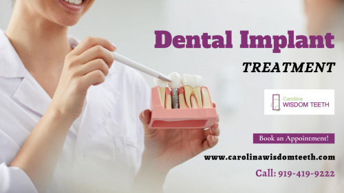 Dental-Implant-Treatment-For-You.png