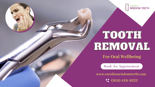 Carolina Wisdom Teeth expertise in professional tooth extraction services in Durham NC for removing the damaged tooth. For more information call us at 919-419-9222 and visit our website.