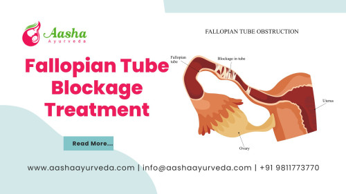 Fallopian Tube Blockage Treatment