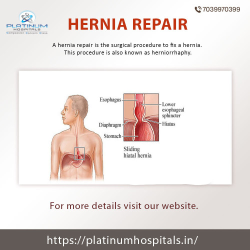 Hernia repair