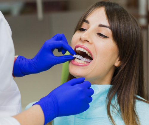 At Orthodontist near Berkeley Heights, we offer patients who choose orthodontics. The type of braces does not have elastic ties that can trap and collect plaque, making them a more hygienic option. Self-ligating braces allow the teeth to move faster and more comfortably. For more information please visit our website https://adsorthodontics.com/orthodontics/