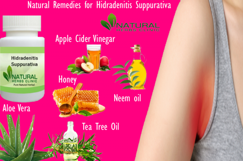 Neem oil has been utilized for a long time in Natural Remedies for Hidradenitis Suppurativa and other skin conditions like acne. It can assist decrease bacteria, redness, and irritation. It also contains a high fatty-acid content, which might support healing... http://naturalherbsclinic.website2.me/naturalremedies/natural-remedies-for-hidradenitis-suppurativa