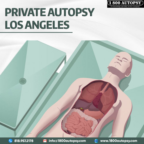 We are always available for immediate action and response. Our extensive network of Autopsy-care providers is always willing to assist. Available to help when an Autopsy is needed. Call anytime.
https://www.1800autopsy.com/