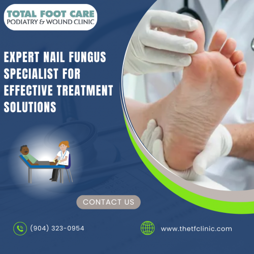 Trust our nail fungus specialist for reliable diagnosis and effective treatment. Visit https://www.thetfclinic.com/