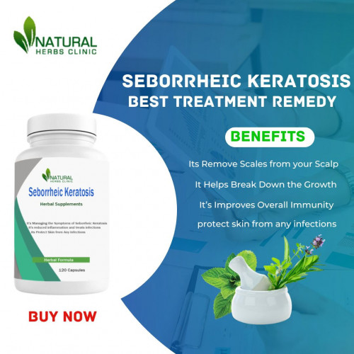Are you looking for Home Treatment for Seborrheic Keratosis? Look no further than Natural Herbs Clinic! Seborrheic keratosis is a common skin condition characterized by wart-like lesions on the face, chest, back, and scalp. Although harmless, these lesions can become itchy and uncomfortable. https://www.articlebowl.com/seborrheic-keratosis-get-the-latest-treatment-information/