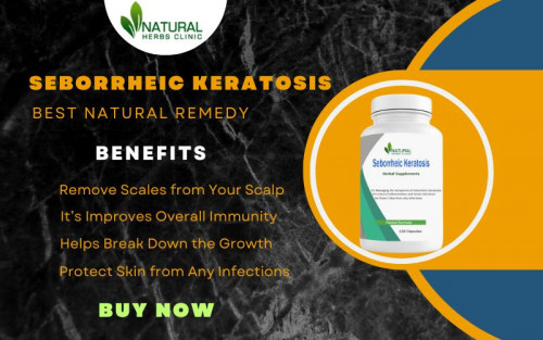 Natural Remedies for Seborrheic Keratosis such as apple cider vinegar and tea tree oil have been proven to help reduce the appearance and discomfort caused by Seborrheic Keratosis, so if you are suffering from this skin condition, give them a try. https://www.naturalherbsclinic.com/blog/seborrheic-keratosis-make-treatment-easy-utilizing-natural-remedies/