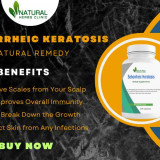 Seborrheic-Keratosis-Make-Treatment-Easy-Utilizing-Natural-Remedies