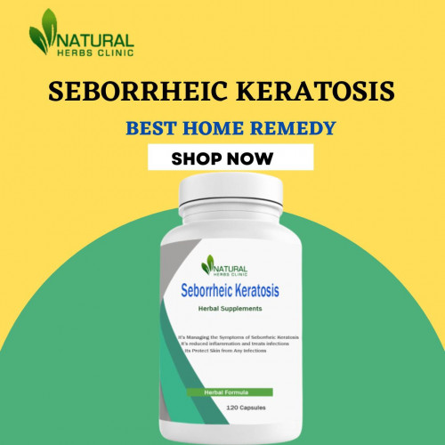 This article offers details on Natural Treatments for Seborrheic Keratosis. Learn how to apply natural treatment to get rid of it. https://www.atoallinks.com/2023/seborrheic-keratosis-read-the-natural-treatments-with-detail/