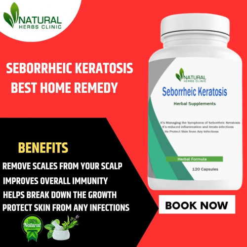 It has been demonstrated that using Natural Remedies for Seborrheic Keratosis, such as apple cider vinegar and tea tree oil, can help with the discomfort and outward signs of the condition. https://tealfeed.com/seborrheic-keratosis-utilize-various-natural-treatments-qctko