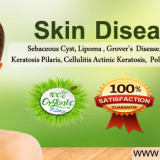 Skin-Disease-Natural-Herbs-Clinic