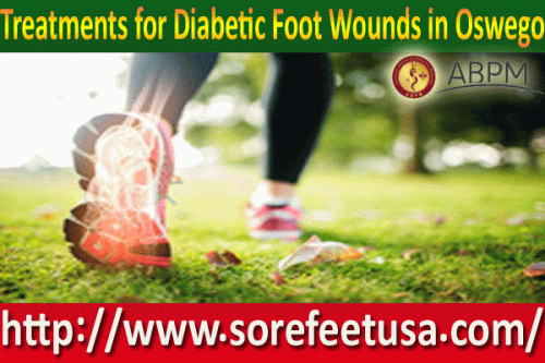 Treatments-for-Diabetic-Foot-Wounds-in-Oswego.gif