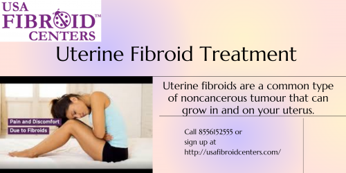 Uterine-Fibroid-Treatment.png