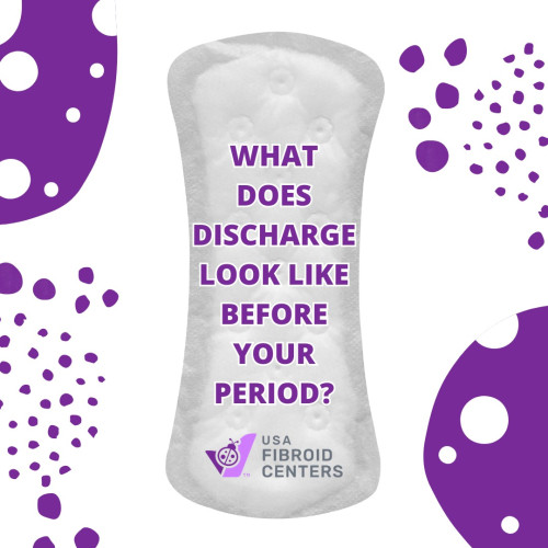 Wondering about clear discharge before period? During menstrual cycle, most women experience various forms of clear discharge before their period and wonder if discharge before period is normal. Here is everything you need to know about discharge before your period!

Visit-
https://www.usafibroidcenters.com/blog/what-does-discharge-look-like-before-your-period/