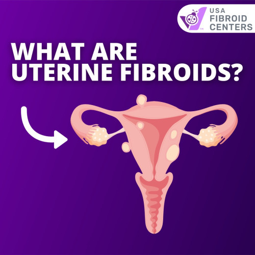 What-are-Uterine-Fibroid.jpg