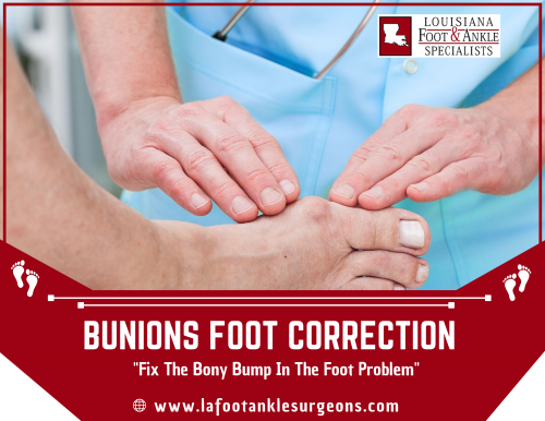 Bunions are distressing bony nodes that develop in the body without any kind over time and give the pain inside the foot at the base of the big toe. For this problem, our doctors will handle the condition of the patient and make surgery and resolve this issue to get a comfortable life. Want to know more? Call us at (337) 474-2233.