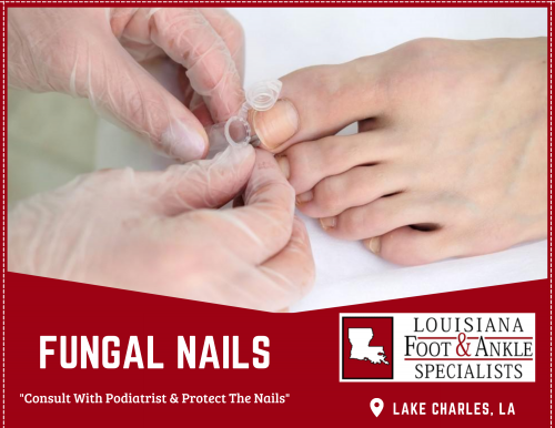 fungal-nails.png