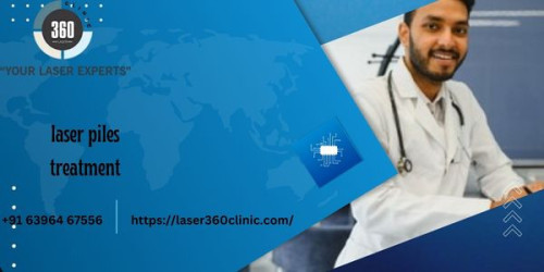The perfect treatments are quick to be performed and serve the patients with a faster discharge process. So, let us now move with the process of laser piles treatment.
https://laser360clinic.com/piles-can-be-cured-flawlessly-by-laser-technology/