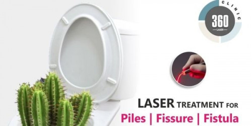 piles-and-fistula-can-be-treated-easily-at-a-laser-clinic.jpg