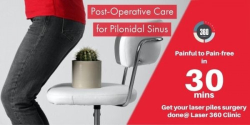 specialties-of-pilonidal-sinus-laser-surgery-patients-must-know-gifyu